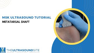 Musculoskeletal ultrasound evaluation of the metatarsal shaft [upl. by Paapanen]