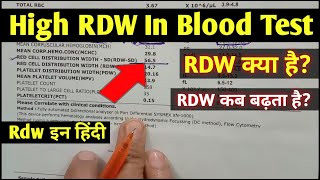 Rdw blood test hindi  High RDW In Blood Test  Rdw test means  Rdw test report [upl. by Diskson]