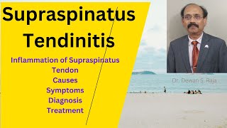 Supraspinatus Tendinitis [upl. by Ttayh820]