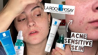 TESTING LA ROCHE POSAY EFFECLAR SKINCARE ROUTINE ON ACNE SENSITIVE DRY SKIN FOR 2 WEEKS [upl. by Sexela]