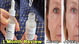 REVIEW on The ordinary Hyaluronic Acid 2  B5 Serum 1 MONTH review with BEFOREAFTER [upl. by Kashden827]