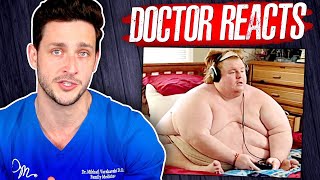 The Harsh Reality Of Being 800 Pounds  Doctor Reacts [upl. by Ballinger]