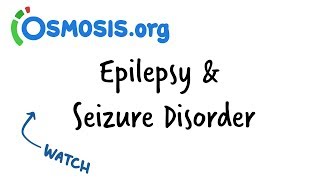 Epilepsy amp Seizure Disorder  Clinical Presentation [upl. by Ecirtnahc625]