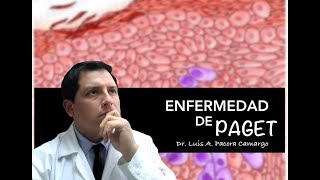 ENFERMEDAD DE PAGET ❗El CÁNCER ⚠️ de PEZÓN 😱 [upl. by Eniaj511]