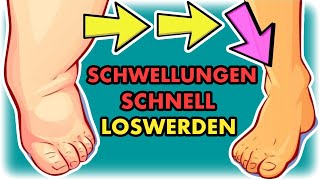 Schwellungen sofort reduzieren Effektive LymphÜbungen für zu Hause [upl. by Eelessej]