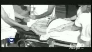 Lobotomy  PBS documentary on Walter Freemanmp4 [upl. by Alleroif]