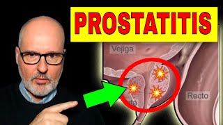 PROSTATITIS AGUDA y CRÓNICA Síntomas Causas y Tratamiento [upl. by Atena47]