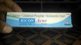 Igcon acne creamuse and side effectsigcon cream best review in hindi acne [upl. by Gaston]