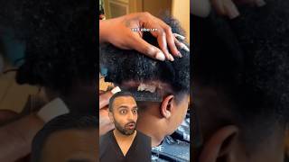 The Importance Of Treating Scalp Psoriasis  Dr Somji Explains [upl. by Aicirtal]