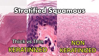 Keratinized vs Non Keratinized Thick vs Thin [upl. by Emina]