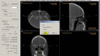 02 Saving DICOM data as an InVivo file InVivoDental Training Videos [upl. by Ezarras]