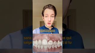 LA VERITÉ SUR LES TACHES APRÈS LES BAGUES DENTAIRES  🦷 dentiste orthodontie appareildentaire [upl. by Dara377]