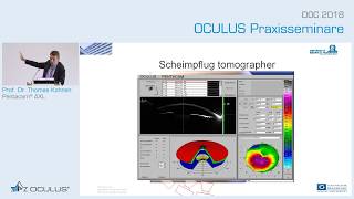 Prof Dr Thomas Kohnen Pentacam® AXL [upl. by Mima]