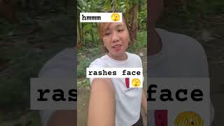 rashes face🫣 [upl. by Lashonda]