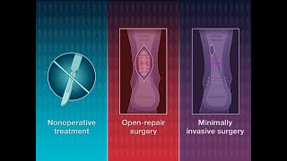 Treatment for Acute Achilles’ Tendon Rupture  NEJM [upl. by Heda]
