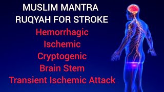 RUQYAH FOR STROKE Transient Ischemic Attack Hemorrhagic Ischemic Cryptogenic and Brain Stem [upl. by Asirehc]