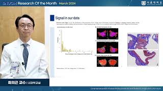 SNU MEDICINE 이달의 연구 2024년 3월 내과학교실 최의근 교수님클론성 조혈증과 심방세동동아시아 코호트 연구 [upl. by Teeniv]