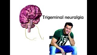 Trigeminal neuralgia  Nerve origin course and supply [upl. by Nairot630]