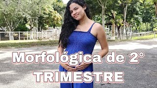 Morfológica de 2° trimestre • Com vídeo da ultrassom [upl. by Adamok]