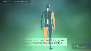 Spinal fracture Symptoms [upl. by Enaillil53]