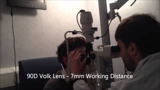 Indirect Ophthalmoscopy with Volk Lens [upl. by Nirtiac]