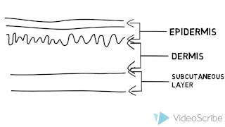 The Basics of Melanoma 5 Ws [upl. by Werdnael]