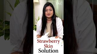 Strawberry Skin Treatment  Keratosis Pilaris  Dos and don’t to treat [upl. by Meng]