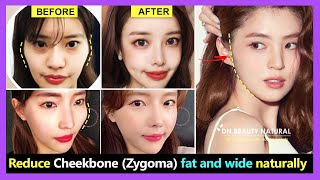 How to reduce Cheekbone fat and wide Zygomatic bone reduction without surgery  Exercise amp Massage [upl. by Arabel]