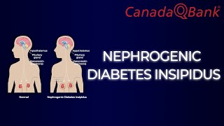 Nephrogenic Diabetes Insipidus [upl. by Benioff]