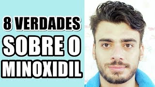 ðŸ”´ MITOS E VERDADES SOBRE MINOXIDIL  COMO FAZER BARBA CRESCER MAIS RÃPIDO [upl. by Musette]