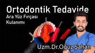 UzmDrOğuz Şahan  Ortodontik tedavide ara yüz fırçası nasıl kullanılmalı Diş telleri temizliği [upl. by Ecnirp]