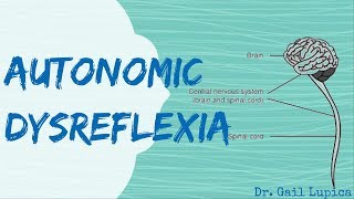 Autonomic Dysreflexia for Nursing Students [upl. by Langbehn]