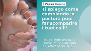 Calli dolorosi Sai che puoi farli scomparire lavorando sulla postura [upl. by Asselem106]