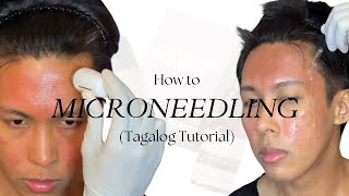 How to Microneedling Tagalog using New Skin New Me  Acne Scar Repair Kit by TCC [upl. by Hotchkiss693]