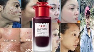 Skintific 12 AHA BHA PHA LHA Peeling Solution  Honest Review [upl. by Aida320]