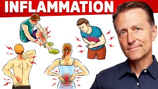 The 1 Best Remedy for Inflammation Autoimmune Gut and Arthritis That You Never Considered [upl. by Etak]