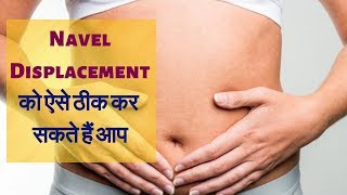 Navel Displacement Treatment using Acupressure Therapy  Shri Jagmohan Sachdeva [upl. by Anairo]