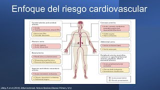 Riesgo cardiovascular un enfoque endocrino desde las dislipidemias LDL alto HDL bajo estatinas [upl. by Hniv839]