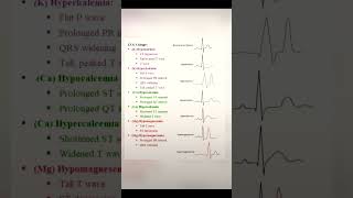 ECG🫀shorts medical ytshorts heart [upl. by Scarlett]