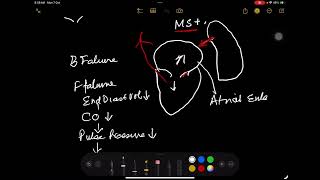 Endocardial Cardiac Defects GKSingh PIMS [upl. by Akemyt]