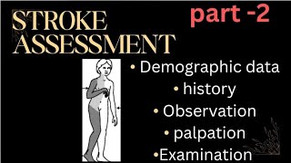 Stroke Assessment part 2 [upl. by Deste]