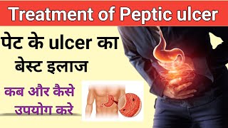 पेट के ulcer का बेस्ट इलाज l Treatment of peptic ulcer [upl. by Sussman]