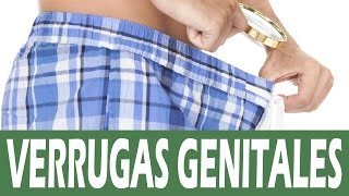 Cómo quitar verrugas genitales – Remedios caseros para las verrugas genitales femeninas masculinas [upl. by Venita88]