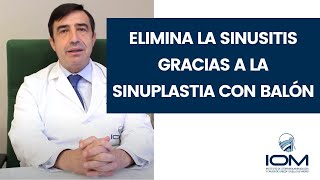 👃‍‍Elimina la sinusitis de una forma segura 🎈 sɪɴᴜᴘʟᴀsᴛɪᴀ con balón de dilatación👇‍‍ [upl. by Latsyek]