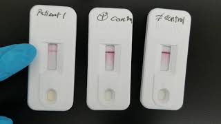 Immunology Infectious Mononucleosis Test [upl. by Arbma]