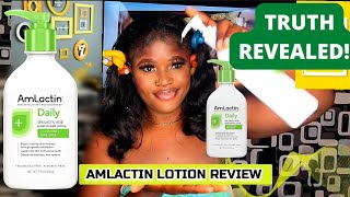 Amlactin Lotion Review Watch this before buying What Amlactin did to my skin Amlactin skincare [upl. by Neiluj218]