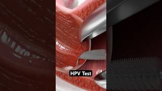 HPV Test 3D Animation [upl. by Aken]