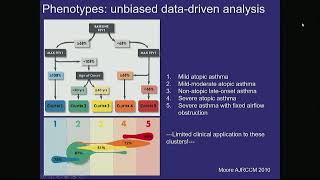 Treatment Options in Severe Eosinophilic Asthma mp4 [upl. by Leuneb619]