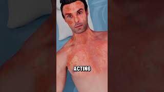 LifeSaving EpiPen Moment During Severe Allergy Attack ⚠️💉viralvideo 3danimation [upl. by Atteloj]