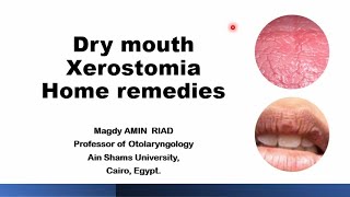 Home remedies for Dry mouth Xerostomia [upl. by Nonnelg]